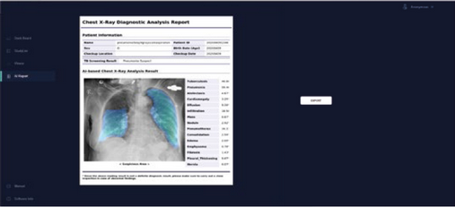 Covid 19 - software di gestione del report radiografie digital Covid 19 - software di generazione del report radiografie digital