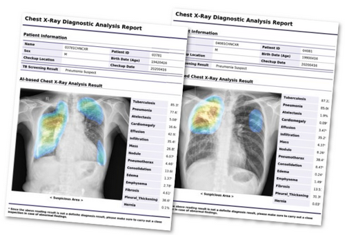 Covid 19 - radiografia digitale rapida