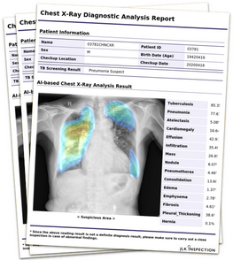 Covid 19 - L'impianto Apolo-D Smartcheck crea dei report velocemente al termine della scansione della persona. Covid 19 - report dell'analisi radiografica digitale