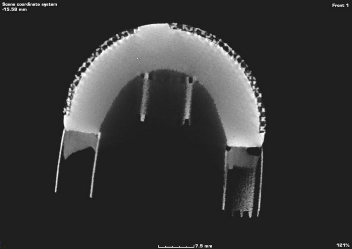 Sezione Tomografica di un Anca Vista interna di Anca al Tomografo
