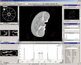 Tomografia computerizzata industriale su pneumatico Analisi tomografica sul pneumatico