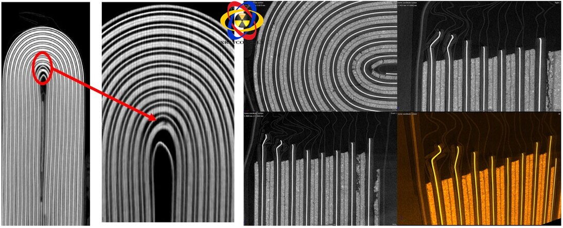 Immagini tomografiche con anomalie nelle batterie