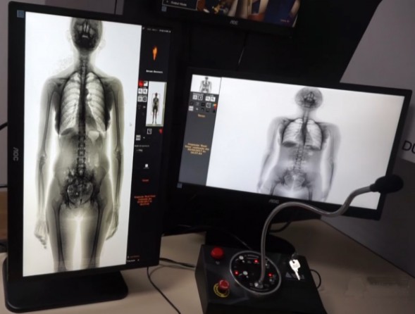 Sicurezza Body Scan per la verifica sopra e dentro le persone