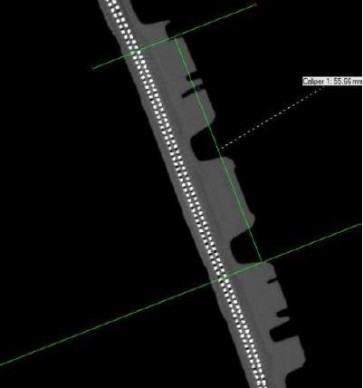 Tomografia computerizzata industriale su pneumatico Visione tomografica trefoli pneumatico