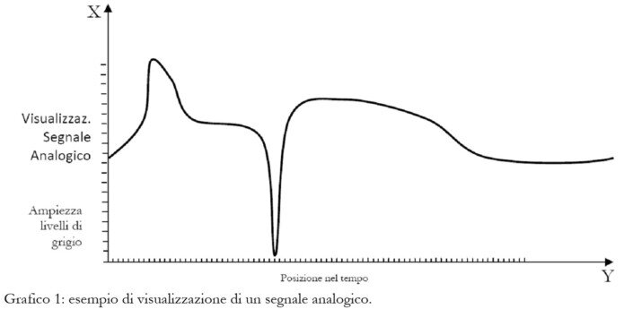 Radiografia digitale - posizione di un segnale analogico